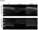 Fig. 85 - CRISPR/CAS9-BASED COMPOSITIONS AND METHODS FOR TREATING RETINAL DEGENERATIONS