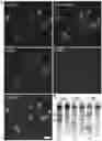 Fig. 01 - Crispr enzymes and systems