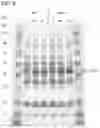 Fig. 09 - BIOSYNTHESIS OF HUMAN MILK OLIGOSACCHARIDES IN ENGINEERED BACTERIA