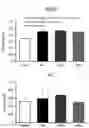 Fig. 04 - Amyotrophic lateral sclerosis diagnostic composition using acid sphingomyelinase, and method for detecting diagnostic markers