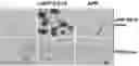 Fig. 01 - METHODS OF DIAGNOSING AND TREATING ALZHEIMER'S DISEASE