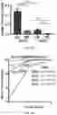 Fig. 44 - METHODS OF DIAGNOSING AND TREATING ALZHEIMER'S DISEASE