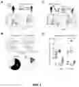 Fig. 02 - PROGNOSIS AND TREATMENT OF RELAPSING LEUKEMIA