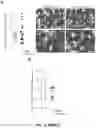 Fig. 41 - PROGNOSIS AND TREATMENT OF RELAPSING LEUKEMIA