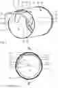 Fig. 06 - WALL SLEEVE SYSTEM FOR A VENTILATION SYSTEM