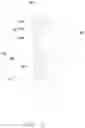Fig. 04 - CABINET DOOR MOUNTING STRUCTURE AND CABINET HAVING SAME
