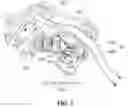 Fig. 04 - Safety device for quick coupler