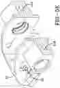 Fig. 10 - Hydraulic caliper assembly