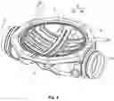 Fig. 12 - Fluid control valve having diaphragm that exclusively biases to closed position and methods of fluid control