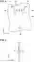 Fig. 05 - Liquid level detection unit
