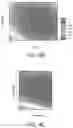 Fig. 07 - Method of sample preparation for Maldi and automated system therefor