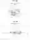 Fig. 15 - Autofocus systems and methods for particle analysis in blood samples