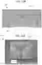 Fig. 21 - Autofocus systems and methods for particle analysis in blood samples