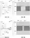 Fig. 03 - Dynamic radiation collimation for non destructive analysis of test objects