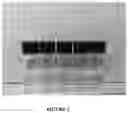 Fig. 03 - Biopharmaceutical aggregation assessment and counterfeit detection using magnetic resonance relaxometry