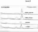 Fig. 09 - Systems and methods for affinity capillary electrophoresis