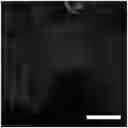 Fig. 01 - Methods for examining podocyte foot processes in human renal samples using conventional optical microscopy