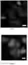 Fig. 10 - Methods for examining podocyte foot processes in human renal samples using conventional optical microscopy