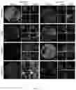Fig. 11 - Methods for examining podocyte foot processes in human renal samples using conventional optical microscopy