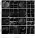 Fig. 12 - Methods for examining podocyte foot processes in human renal samples using conventional optical microscopy