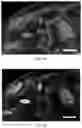 Fig. 25 - Methods for examining podocyte foot processes in human renal samples using conventional optical microscopy