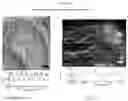 Fig. 27 - Methods for examining podocyte foot processes in human renal samples using conventional optical microscopy