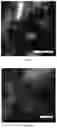 Fig. 36 - Methods for examining podocyte foot processes in human renal samples using conventional optical microscopy