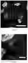 Fig. 38 - Methods for examining podocyte foot processes in human renal samples using conventional optical microscopy