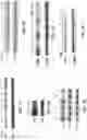 Fig. 05 - Saposin-A derived peptides and uses thereof