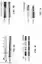 Fig. 06 - Saposin-A derived peptides and uses thereof