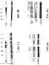 Fig. 07 - Saposin-A derived peptides and uses thereof