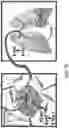 Fig. 13 - Saposin-A derived peptides and uses thereof