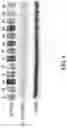 Fig. 14 - Saposin-A derived peptides and uses thereof