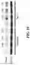 Fig. 16 - Saposin-A derived peptides and uses thereof