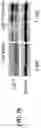 Fig. 28 - Saposin-A derived peptides and uses thereof