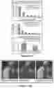 Fig. 16 - METHODS APPARATUSES AND SYSTEMS FOR DETECTING AND QUANTIFYING PHOSPHOPROTEINS
