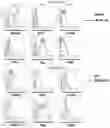 Fig. 49 - T CELL BALANCE GENE EXPRESSION, COMPOSITIONS OF MATTERS AND METHODS OF USE THEREOF