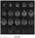 Fig. 74 - Low-field magnetic resonance imaging methods and apparatus