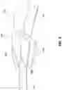 Fig. 03 - Convex light reflection viewing device