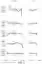 Fig. 04 - Lens assembly and fabrication method thereof