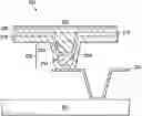 Fig. 01 - Micromechanical device with via strut