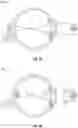 Fig. 11 - Methods and systems for diagnosing and treating eyes using light therapy