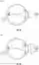 Fig. 12 - Methods and systems for diagnosing and treating eyes using light therapy