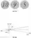 Fig. 28 - Methods and systems for diagnosing and treating eyes using light therapy
