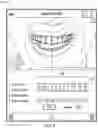 Fig. 09 - SYSTEM AND METHOD FOR GENERATING AN ORTHODONTIC APPLIANCE