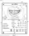 Fig. 10 - SYSTEM AND METHOD FOR GENERATING AN ORTHODONTIC APPLIANCE