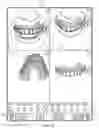 Fig. 12 - SYSTEM AND METHOD FOR GENERATING AN ORTHODONTIC APPLIANCE