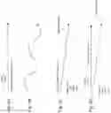 Fig. 05 - Tremor correction for gesture recognition