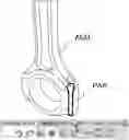 Fig. 01 - Method for generating a movement of a three-dimensional part of a three-dimensional assembly in a three-dimensional scene, comprising at least a rotation at most by a predetermined angle