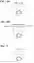 Fig. 08 - Apparatus detecting driving incapability state of driver